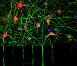 Local protein synthesis in neurons