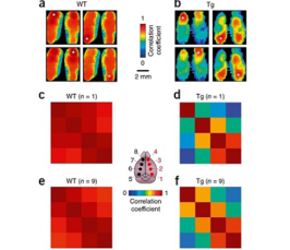 In vivo neuronal dysfunctions in mouse models of Alzheimer's disease